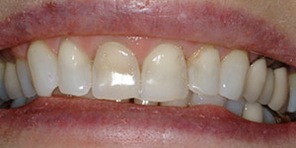 Before image