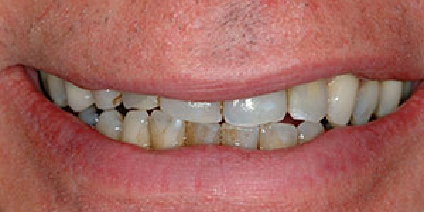 Before image
